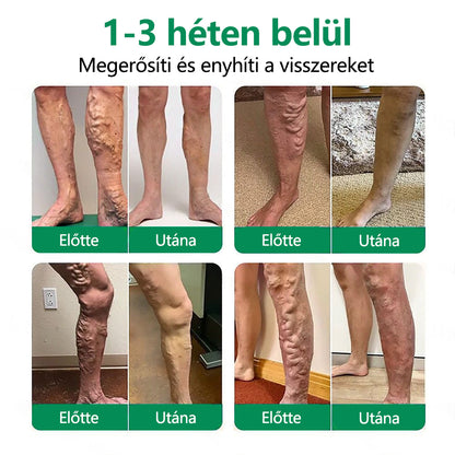 CleraNaure® VeinTarget Mikrotűs Pólya 🗽 Azonnali Enyhülés, Hosszú Távú Eredmények