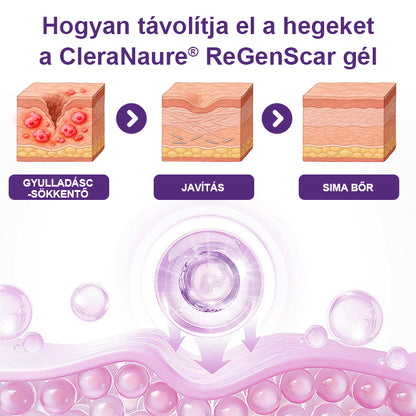 🥇CleraNaure® ReGenScar Őssejtes Hegkezelő Gél