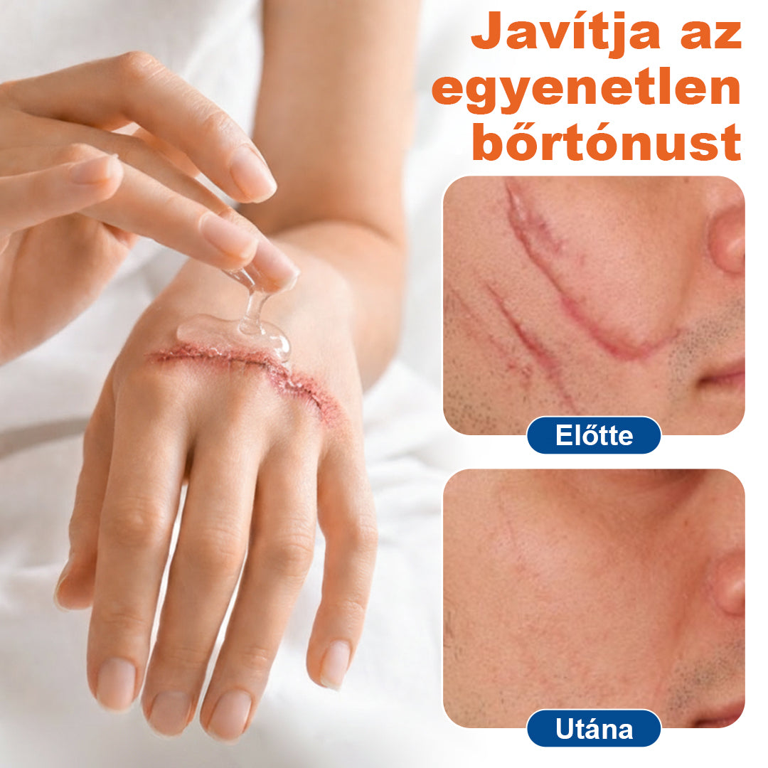 CleraNaure® DermalRebuild Bőrfelújító Gél