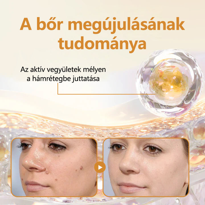 CleraNature® Méhméreg Szemölcs Megújító Spray