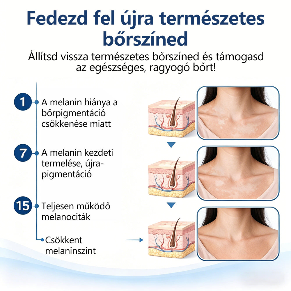 CleraNaure® Piperin Vitiligo újrapigmentáló permet – 🌿Szteroidmentes növényi összetétel | Kíméletes és hatékony minden bőrtípushoz