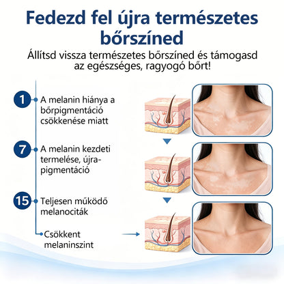 CleraNaure® Piperin Vitiligo újrapigmentáló permet – 🌿Szteroidmentes növényi összetétel | Kíméletes és hatékony minden bőrtípushoz