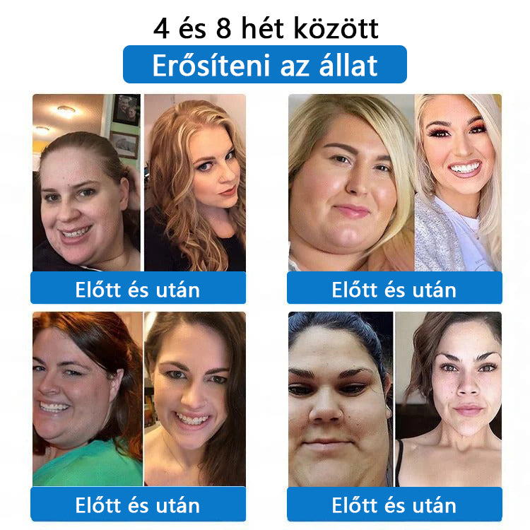 ⭐⭐⭐CleraNaure® 7-v-1 metabolikus és feszesítő tapasz (mikrodifúziós technológia, 24 órás hatás) a testsúly, étvágy, energia és cukoranyagcsere szabályozására 💡