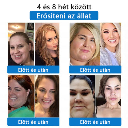 ⭐⭐⭐CleraNaure® 7-v-1 metabolikus és feszesítő tapasz (mikrodifúziós technológia, 24 órás hatás) a testsúly, étvágy, energia és cukoranyagcsere szabályozására 💡