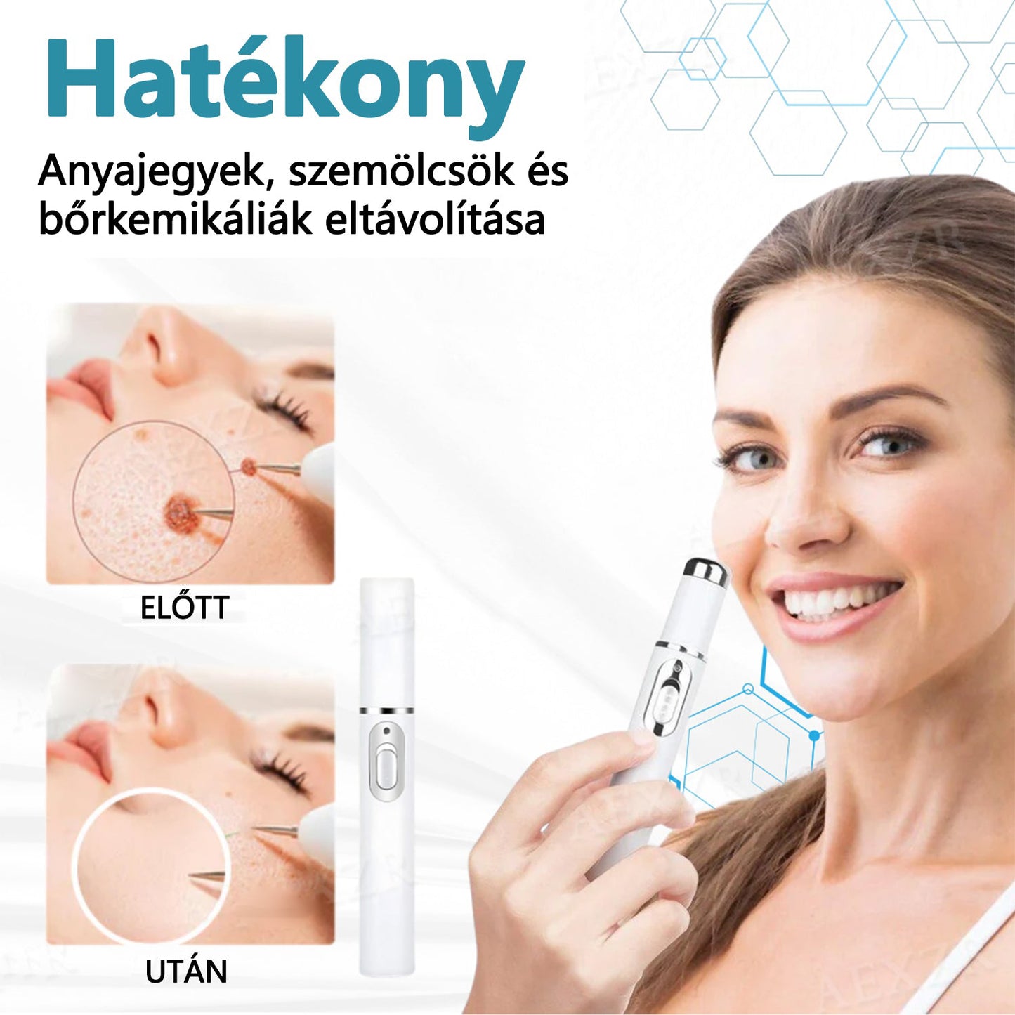 CleraNaure®  ajánlásával – non-invazív lézertoll szemölcsökre és anyajegyekre🔦🔦