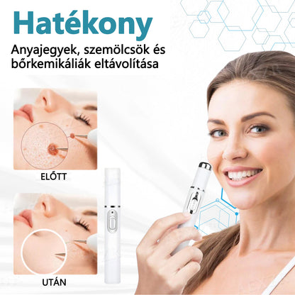 CleraNaure®  ajánlásával – non-invazív lézertoll szemölcsökre és anyajegyekre🔦🔦