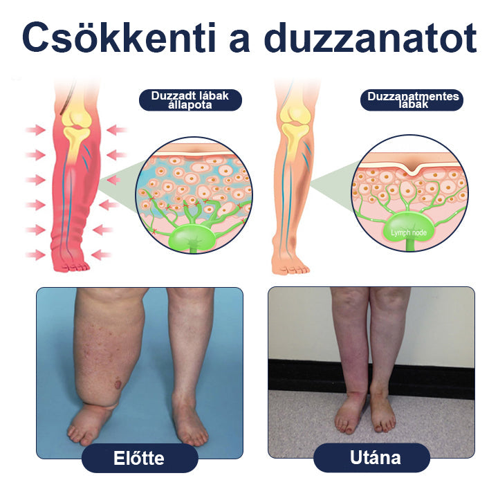 CleraNaure® SwellRelief Keringés Támogató Krém