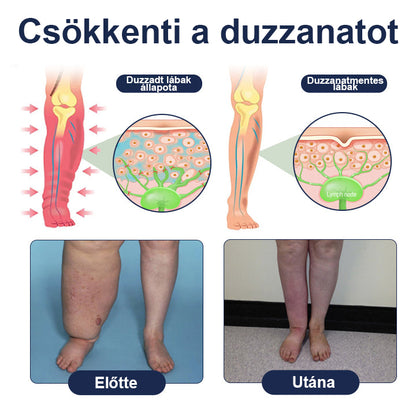 CleraNaure® SwellRelief Keringés Támogató Krém