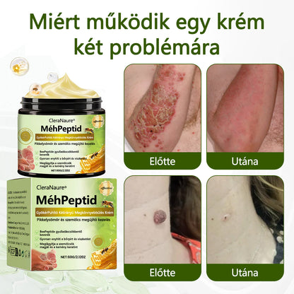 CleraNaure® BeePeptide RootSoft DualRelief krém