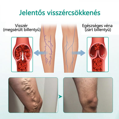CleraNaure® LegRenew Visszértágulat Párna