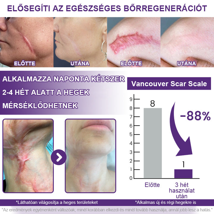 🥇CleraNaure® ReGenScar Őssejtes Hegkezelő Gél