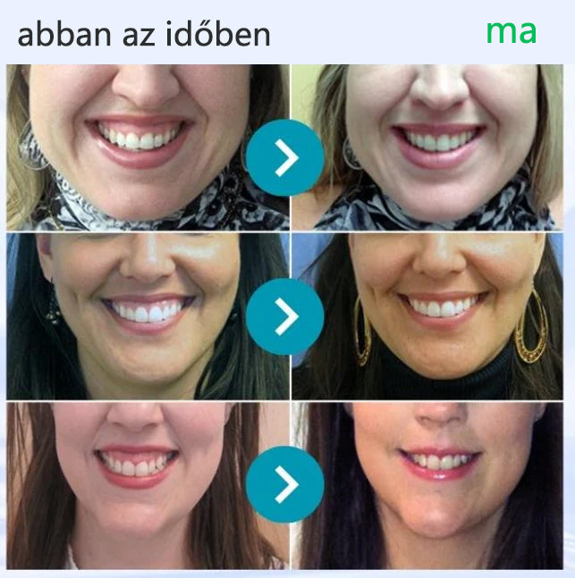 CleraNaure® VioCore Méregtartalmú Fogászati Kezelő Fogkrém