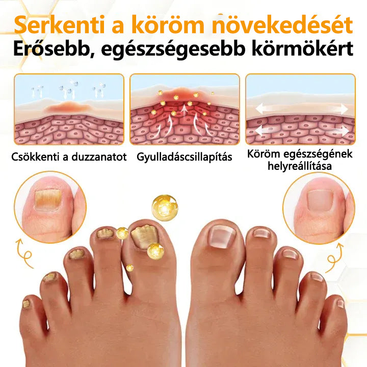 CleraNature® Antifungális Köröm Revitalizáló Olaj Méhméreggel