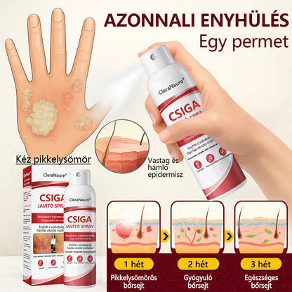 CleraNature® Bálnazsír Spray Viszkető, Hámló Psoriasisra Hajlamos Bőrre