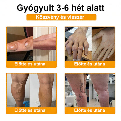 CleraNaure® Méhméreg Fájdalomcsillapító Csontregeneráló Krém (Kifejezetten idősebb felnőttek számára)