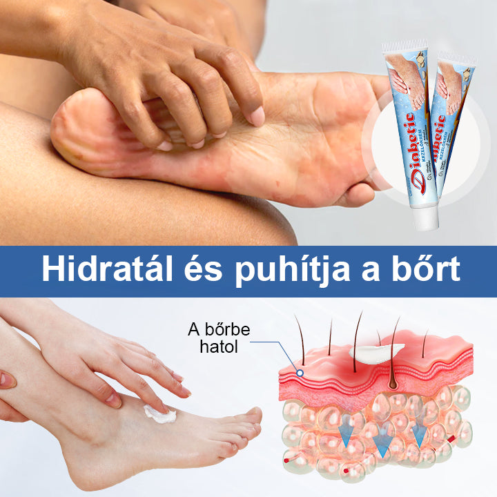 CleraNature® VitaGluco Cukorbetegség Kezelő Krém - 👨‍⚕️Bőrgyógyászok Által Ajánlott Formula