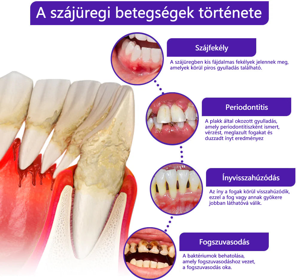 CleraNaure® VioCore Méregtartalmú Fogászati Kezelő Fogkrém