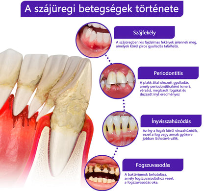 CleraNaure® VioCore Méregtartalmú Fogászati Kezelő Fogkrém