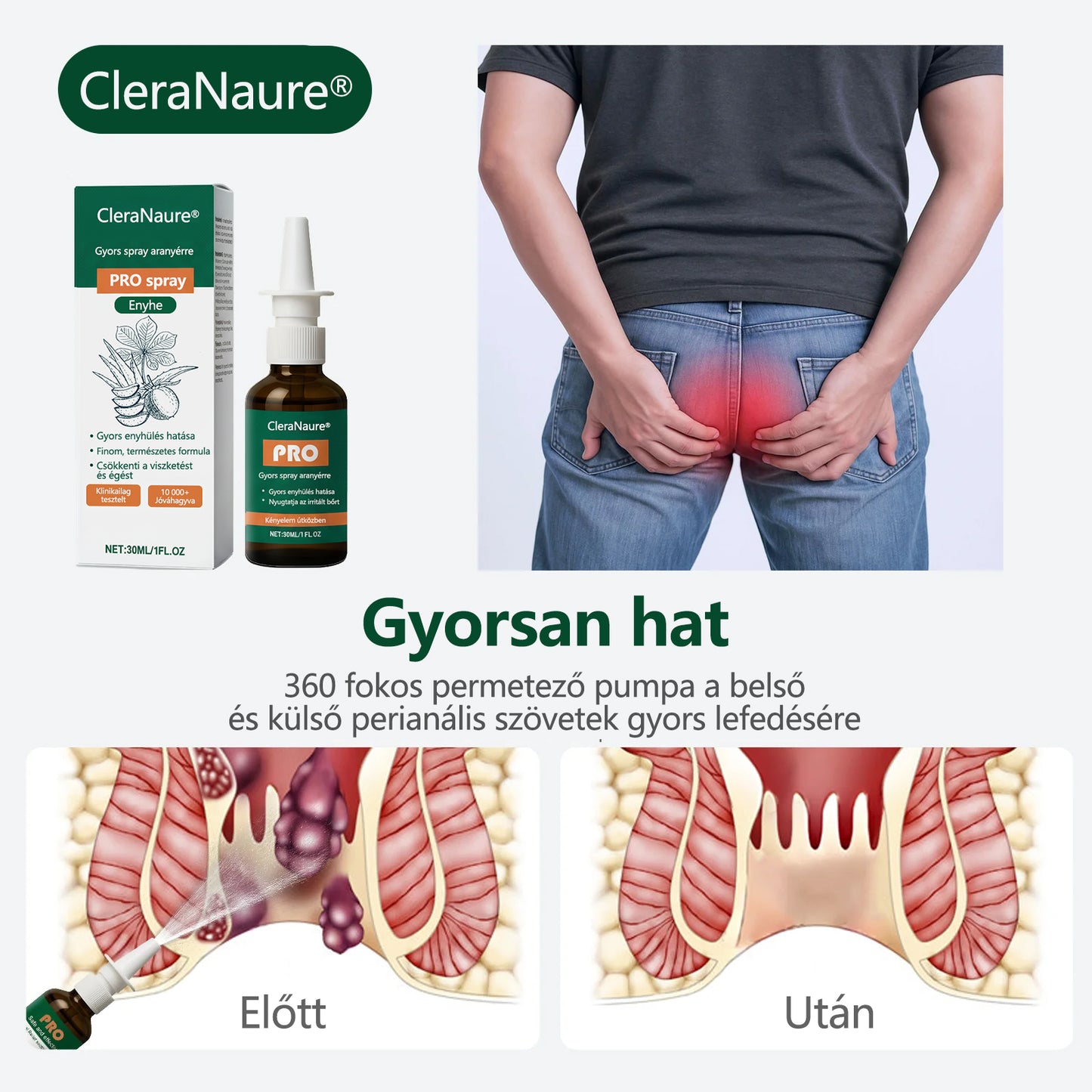 🎁 Időszakos ajánlat | CleraNaure® Gyors Aranyér PRO Spray