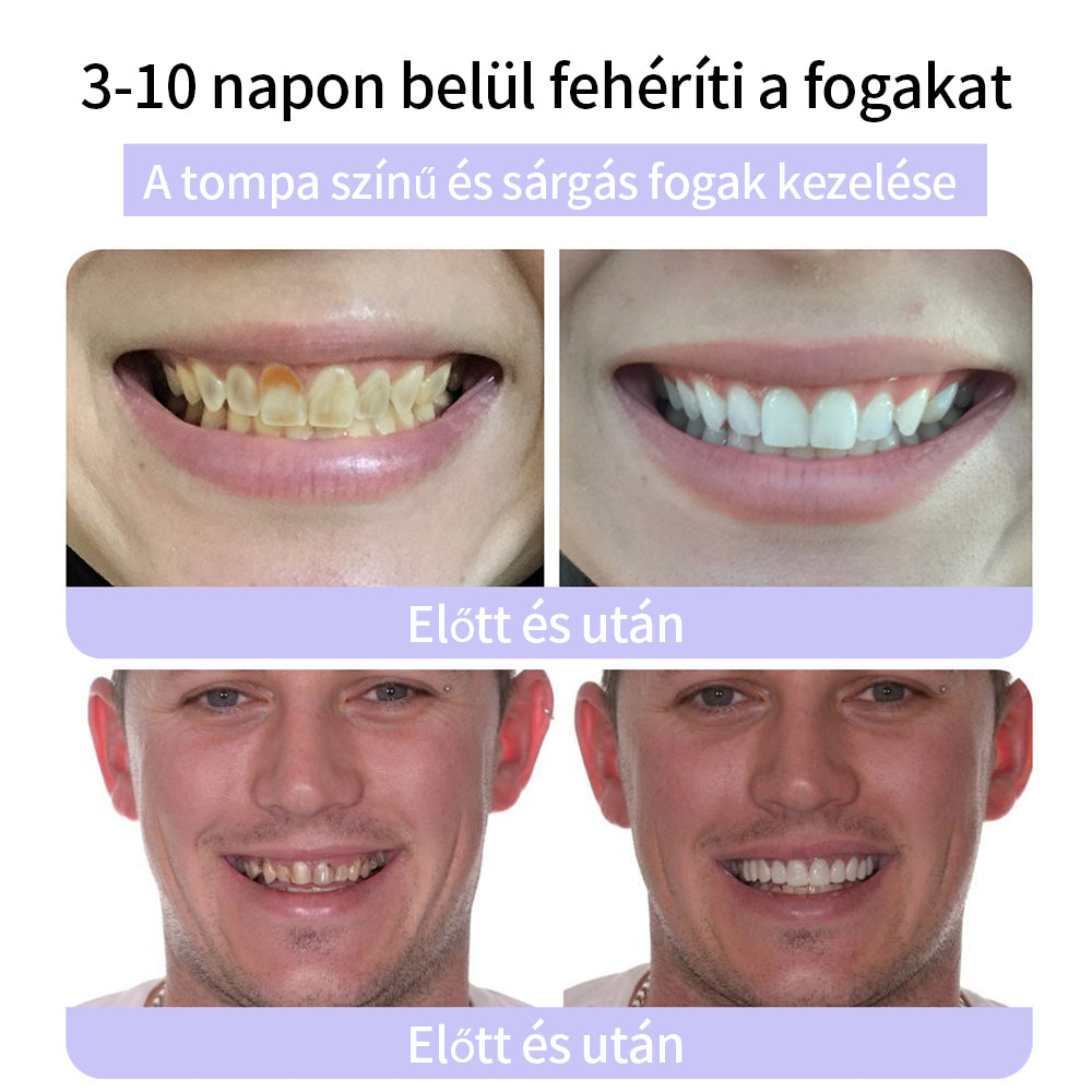 CleraNature® Fogak Helyreállító Ásványi Por