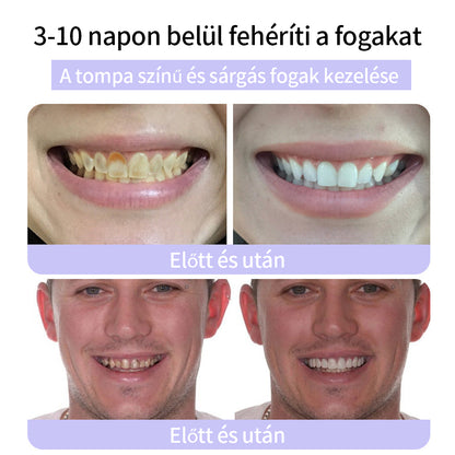 CleraNature® Fogak Helyreállító Ásványi Por