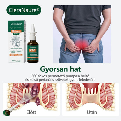 🎁 Időszakos ajánlat | CleraNaure® Gyors Aranyér PRO Spray