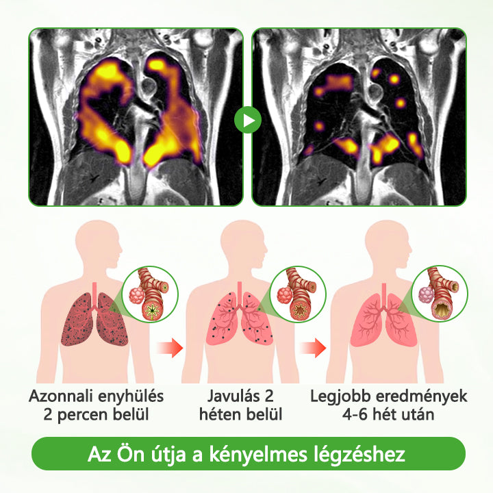 🏅Hivatalos márkabolt✅CleraNaure® HerbaAir Mullein Tüdőtisztító💎
