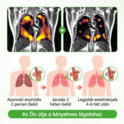 🏅Hivatalos márkabolt✅CleraNaure® HerbaAir Mullein Tüdőtisztító💎