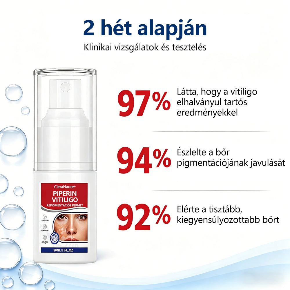 CleraNaure® Piperin Vitiligo újrapigmentáló permet – 🌿Szteroidmentes növényi összetétel | Kíméletes és hatékony minden bőrtípushoz