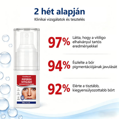 CleraNaure® Piperin Vitiligo újrapigmentáló permet – 🌿Szteroidmentes növényi összetétel | Kíméletes és hatékony minden bőrtípushoz