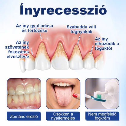 COLTURE® GumHoney Fogínyhelyreállító Cseppek