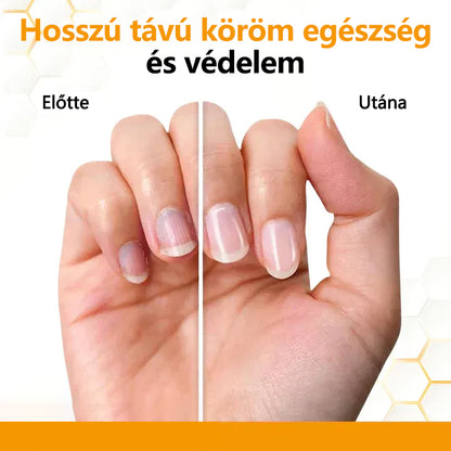 CleraNature® Antifungális Köröm Revitalizáló Olaj Méhméreggel