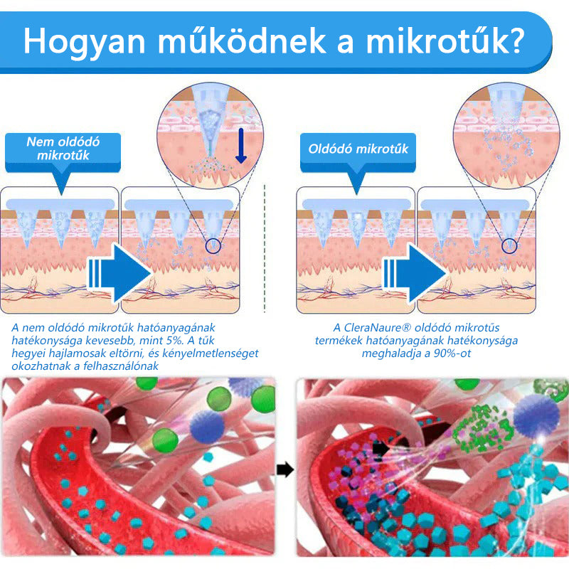 ⭐⭐⭐CleraNaure® 7-v-1 metabolikus és feszesítő tapasz (mikrodifúziós technológia, 24 órás hatás) a testsúly, étvágy, energia és cukoranyagcsere szabályozására 💡