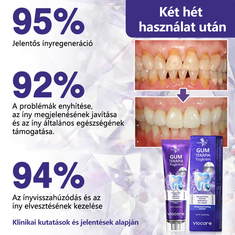 CleraNaure® VioCore Méregtartalmú Fogászati Kezelő Fogkrém