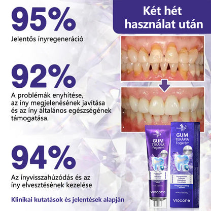CleraNaure® VioCore Méregtartalmú Fogászati Kezelő Fogkrém