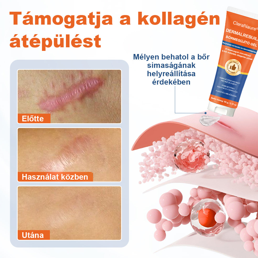 CleraNaure® DermalRebuild Bőrfelújító Gél
