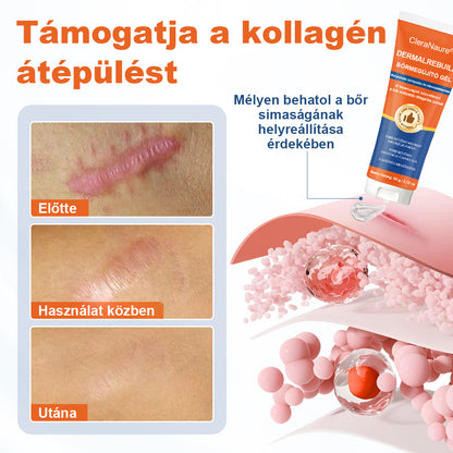 CleraNaure® DermalRebuild Bőrfelújító Gél