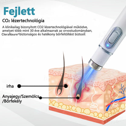 CleraNaure®  ajánlásával – non-invazív lézertoll szemölcsökre és anyajegyekre🔦🔦