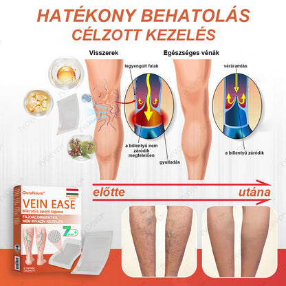 CleraNaure® Vein Ease Mikrotűs Kezelő Pecsét (Pókháló Vénák, Visszér, Duzzanat és Lábfáradtság Ellen)