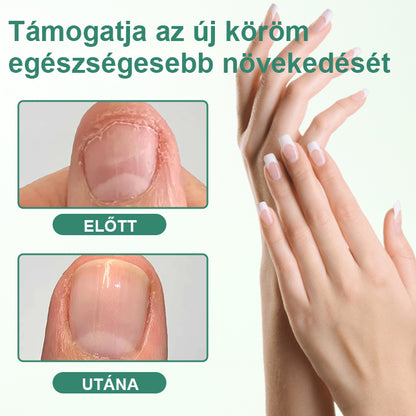 CleraNaure® Körömméregtelenítő Penetrációs Szérumtoll