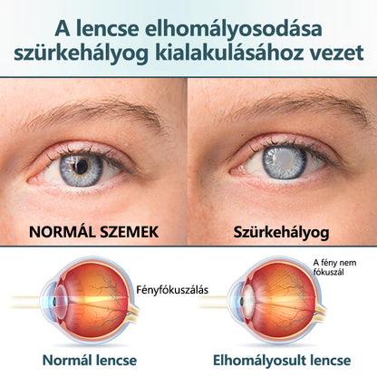 💎CleraNaure® Optifusion Nano Szemcsepp Szérum-A nanotechnológia visszaállítja a tiszta látást, szemüveg nélkül, műtét nélkül