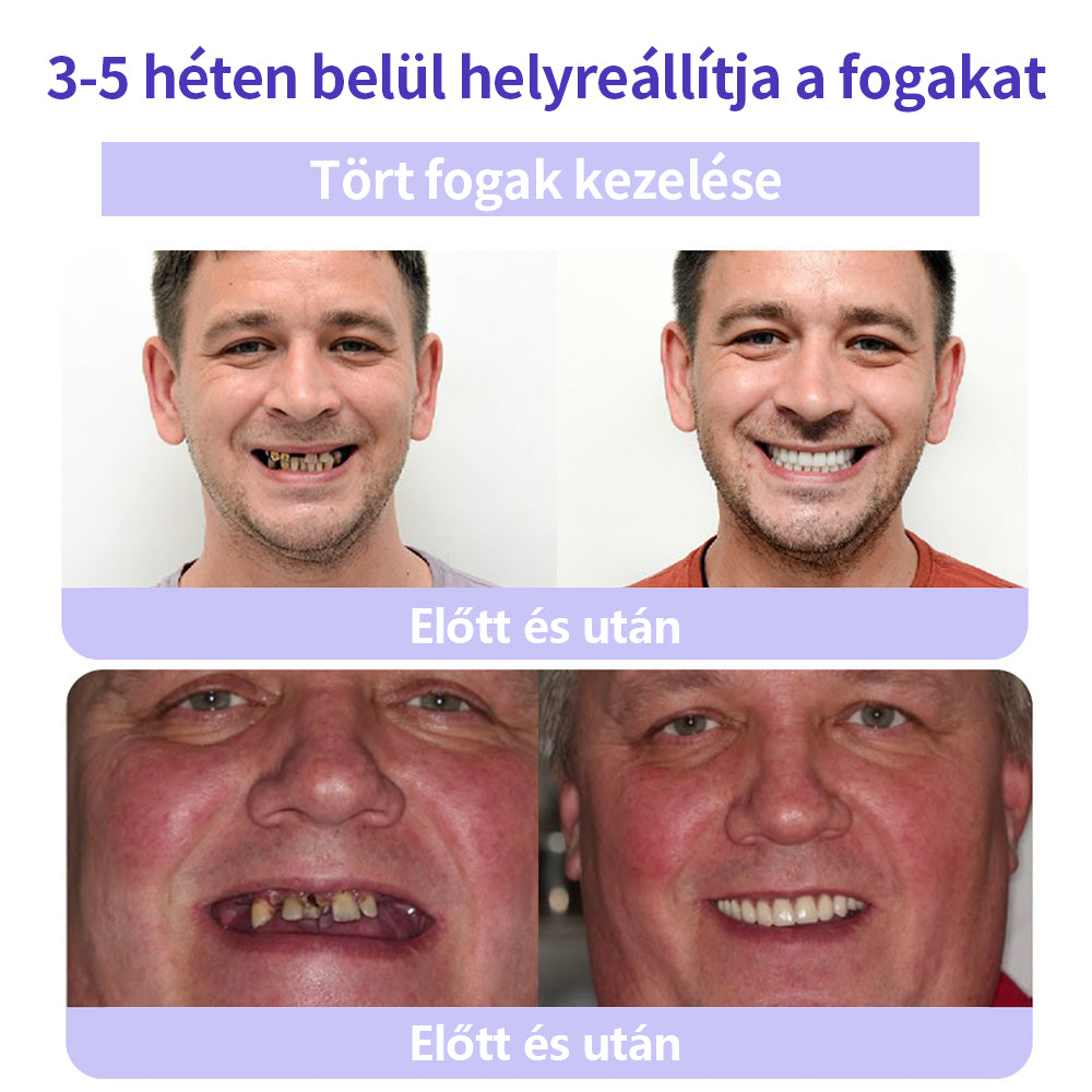 CleraNature® Fogak Helyreállító Ásványi Por