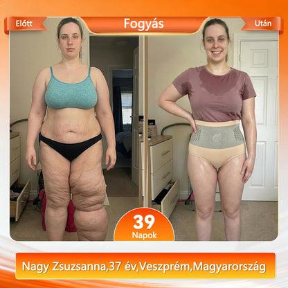 Hivatalos márkabolt | CleraNaure® 2026 Moringa és Berberin 4 az 1-ben mikrorészecskés alakformáló és zsírégető rövidnadrág