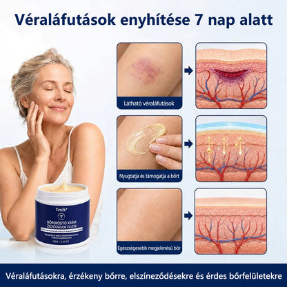 💥Timilk® Bőrerősítő Krém Zúzódások Ellen💥💥