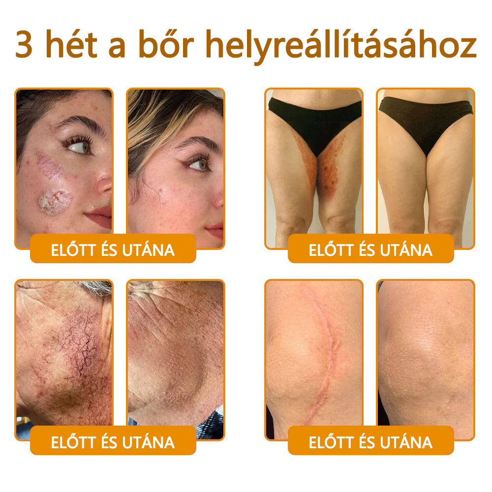 ✨CleraNaure® Méhméreg Bőrregeneráló Krém✨