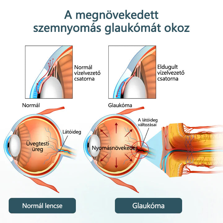 💎CleraNaure® Optifusion Nano Szemcsepp Szérum-A nanotechnológia visszaállítja a tiszta látást, szemüveg nélkül, műtét nélkül