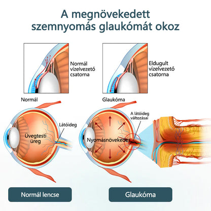 💎CleraNaure® Optifusion Nano Szemcsepp Szérum-A nanotechnológia visszaállítja a tiszta látást, szemüveg nélkül, műtét nélkül