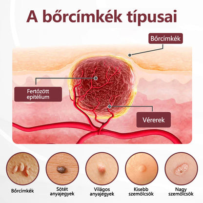 ⭐Hivatalos áruház👨‍⚕️ CleraNaure® KeraErase - Kettős hatású bőrfiatalító krém 👨‍⚕️ (Kettős hatású fiatalítás – simítja a kiemelkedő dudorokat és lebontja a mélyen lerakódott keratint savak és irritáció nélkül
