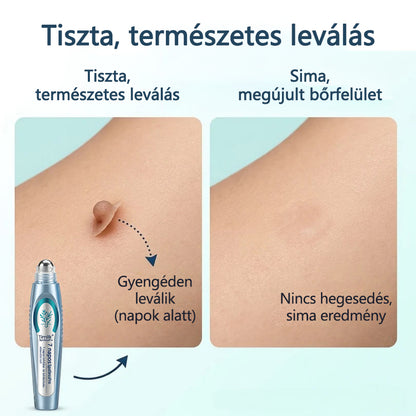 🖊 Timilk® SpotlessPro Fejlett Bőrápoló Toll 🖊