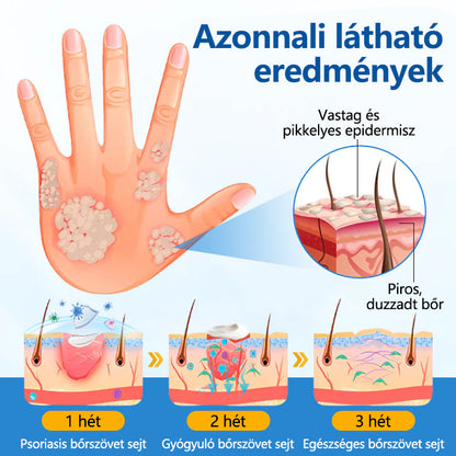 🛡️🛡️CleraNaure® Töredezett Bőrre Helyreállító Krém🛡️🌿 Többfunkciós Regeneráló Zúzódások, Szárazság és Pattanások Ellen